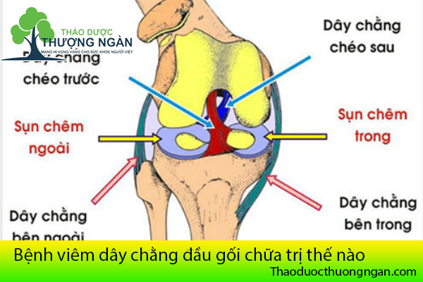 Ôn đinh và kháng viêm là phương pháp nào được sử dụng để điều trị viêm gân dây chằng khớp gối?
